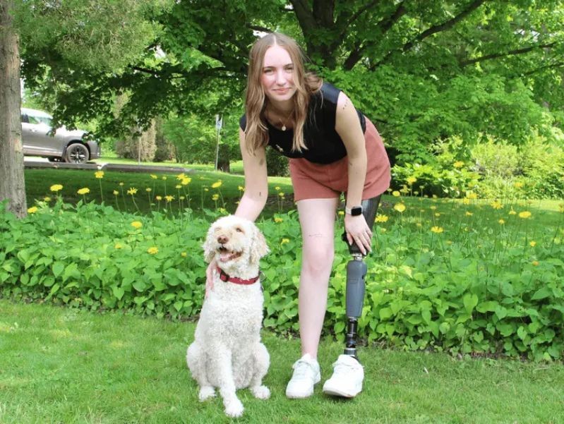 Osteosarcoma survivors Molly and Kara Skrubis